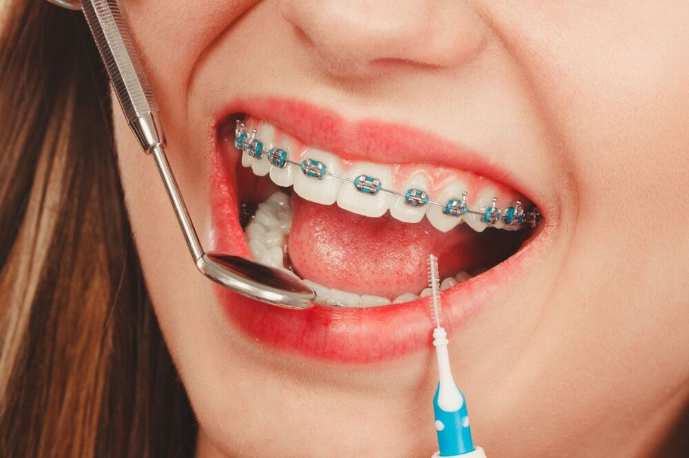 dental treatments in Albania