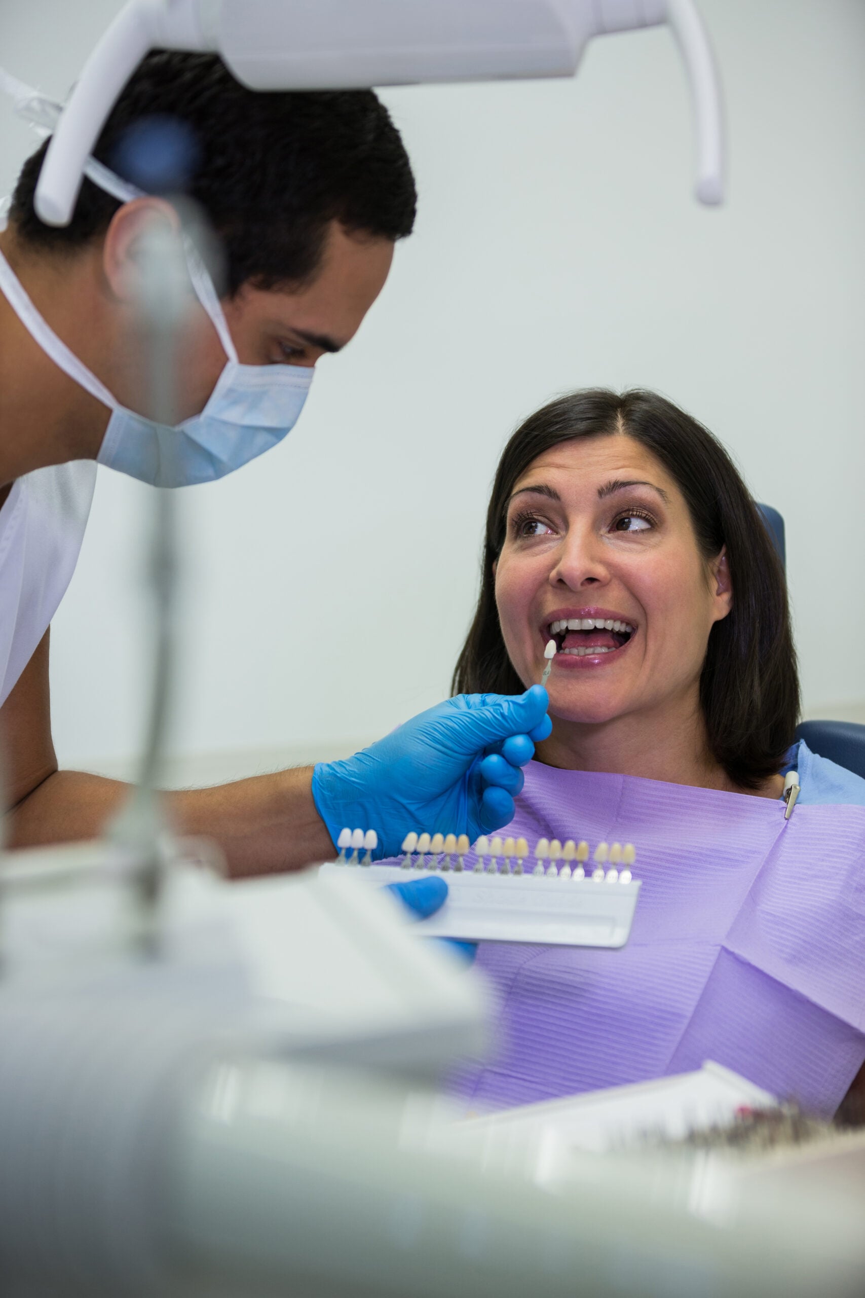 Composite Veneers