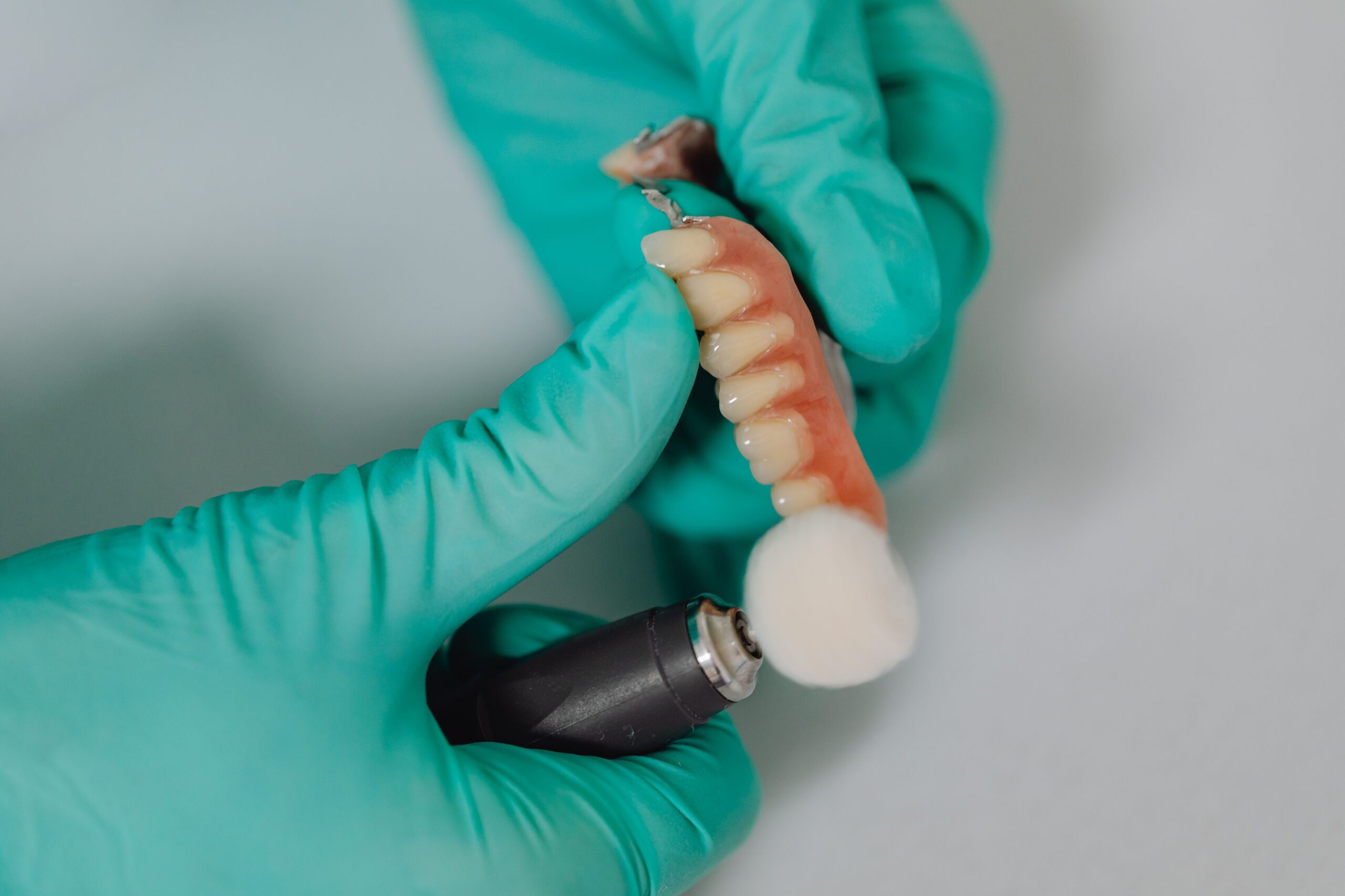 What Is It Like to Replace All Your Teeth with Full-Arch Dental Implants?