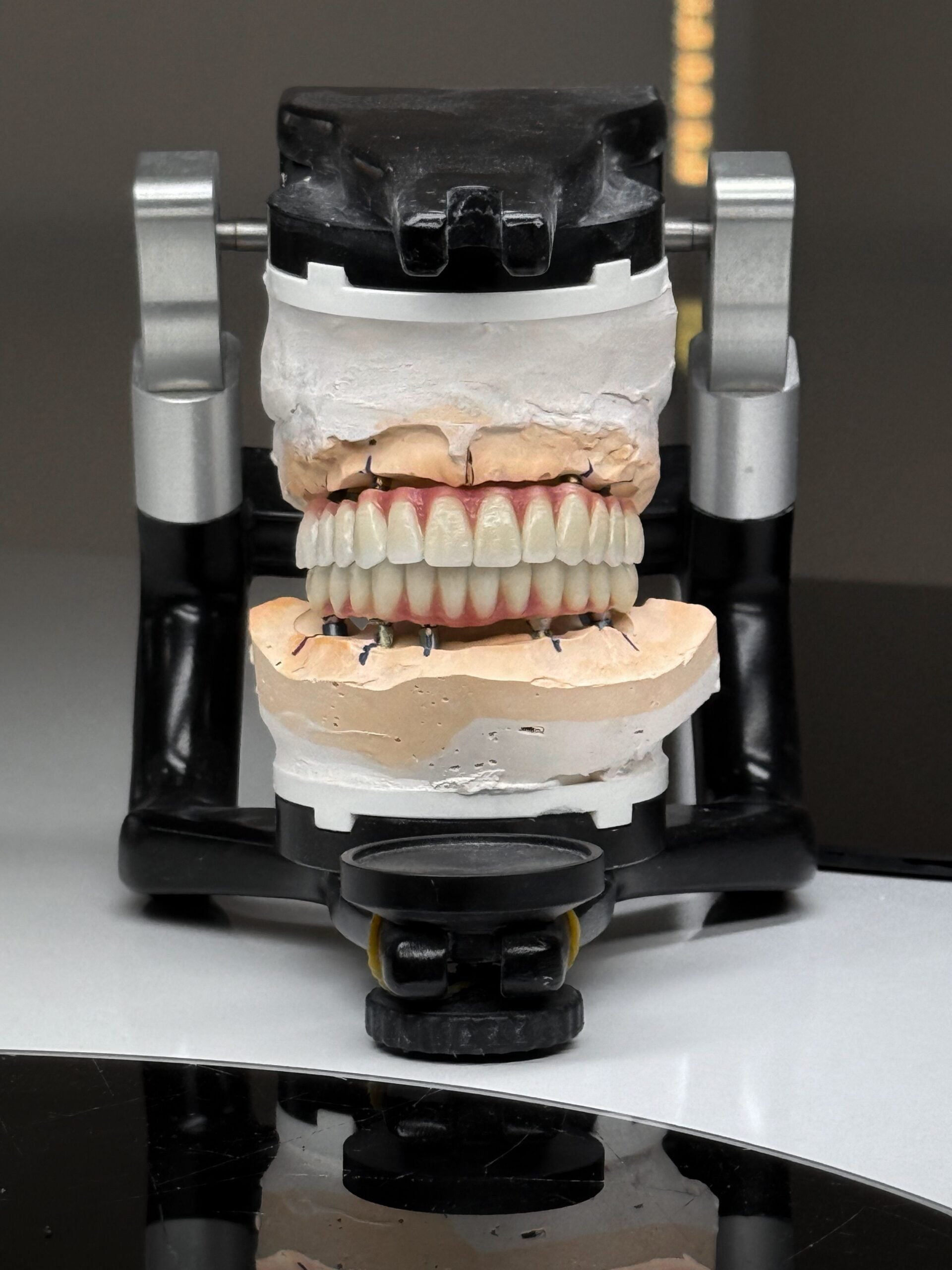 Dental Prosthetics