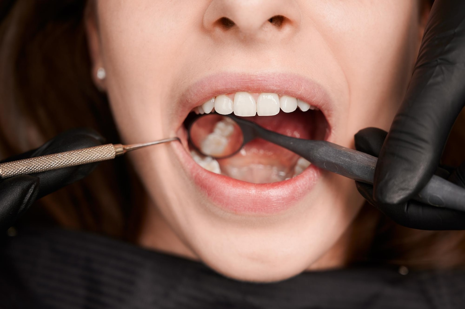 Correct Your Tooth Imperfections with Evo Dental
